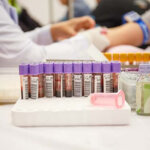 mobile-blood-testing-inland-empire mobile-blood-testing-inland-empire